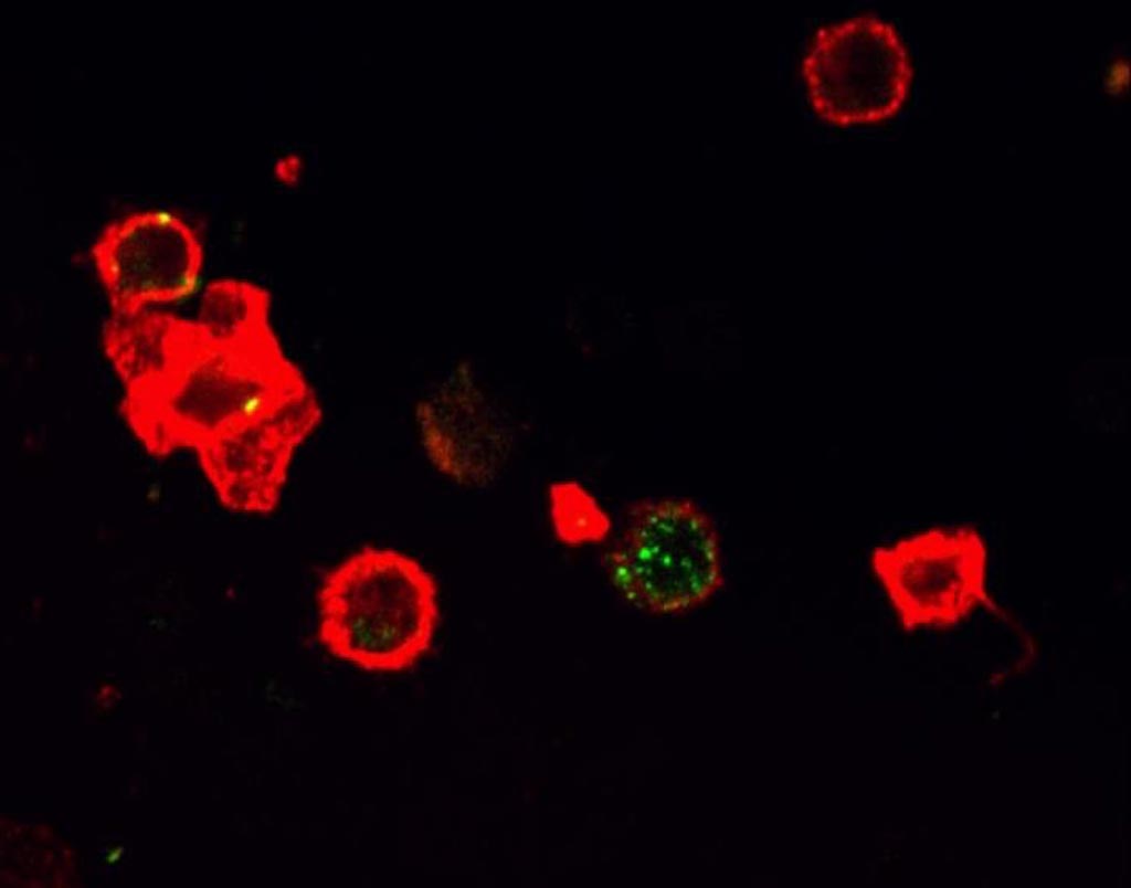 Image: A confocal microscope image shows the SA-4-1BBL (green color) bound to its receptor on an immune cell (red color) to initiate an immune activation cascade to fight cancer (Photo courtesy of the University of Louisville).
