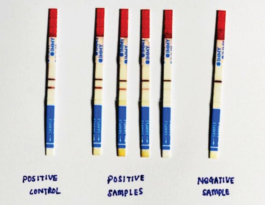 Image: Test strips of IMMY Cryptococcal Antigen Lateral Flow Assay kit (LFA) (Photo courtesy of the Institute for Medical Research, Kuala Lumpur, Malaysia).