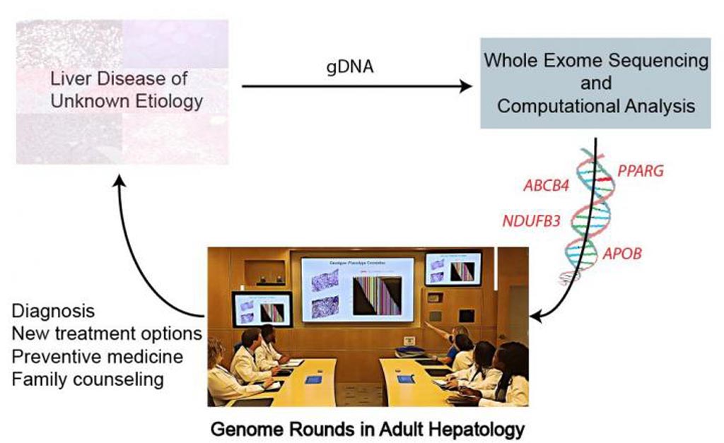 Image: The use of WES on adults with liver disease of unknown cause illustrates the potential clinical value of genome rounds in the individual assessment and medical care of patients (Photo courtesy of the Yale School of Medicine / Journal of Hepatology).
