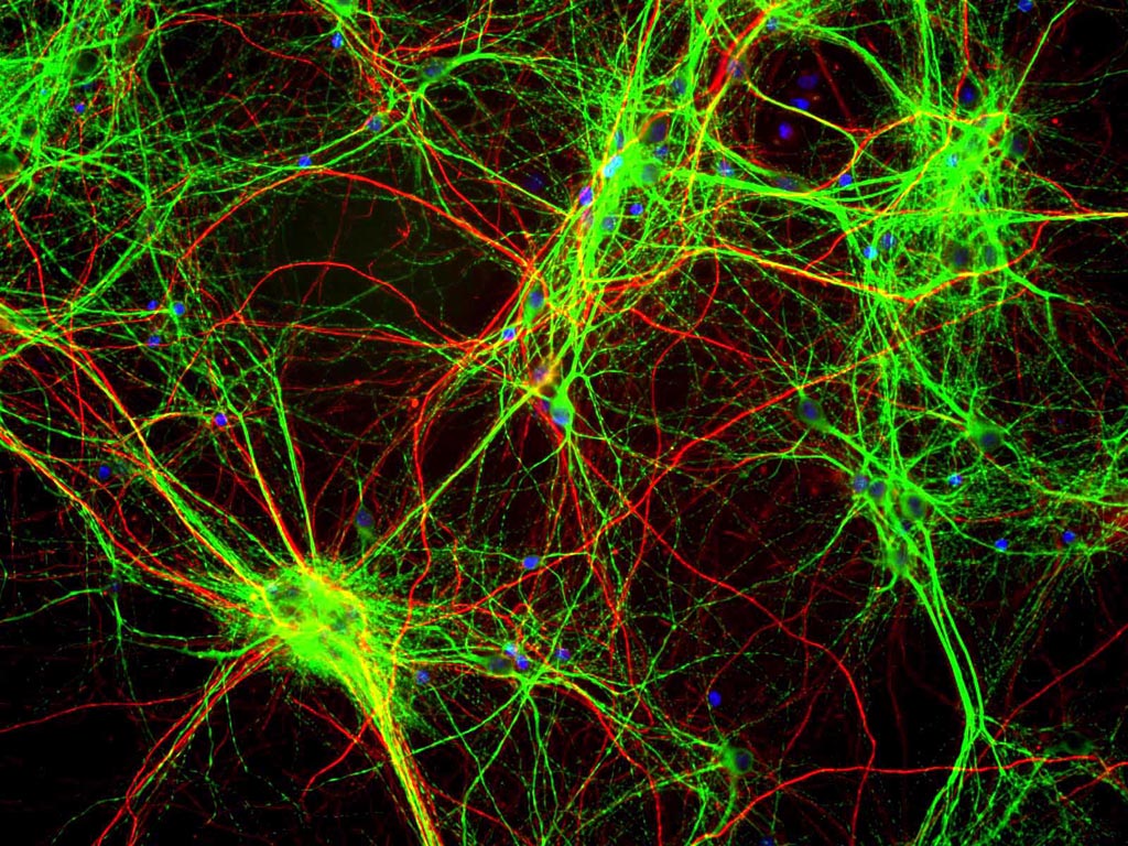 Image: Neurofilaments (red) in cultured rat brain cells (Photo courtesy of Wikimedia Commons).