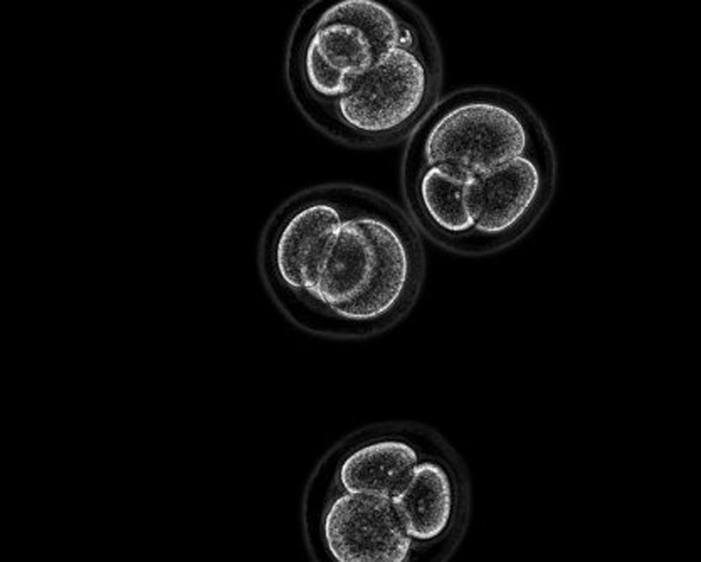 Image: A micrograph showing four-cell stage mouse embryos (Photo courtesy of Kirill Makedonski, the Hebrew University of Jerusalem).