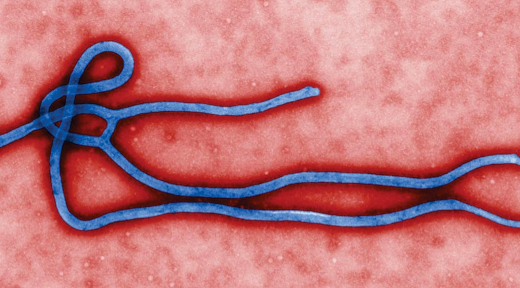 Image: A digitally colorized, transmission electron microscopic (TEM) image, which reveals some of the ultrastructural morphology displayed by an Ebola virus virion (Photo courtesy of Cynthia Goldsmith / CDC).