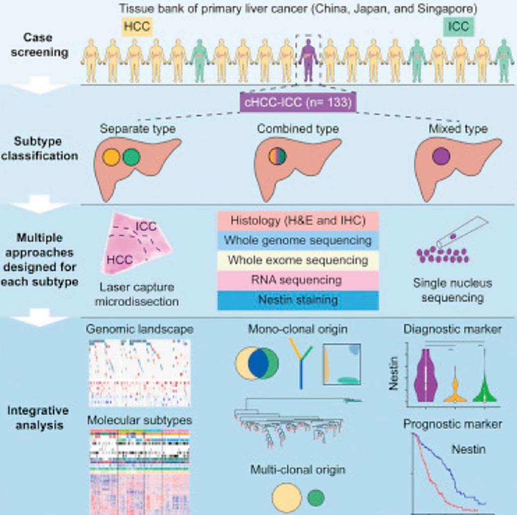 Image: A diagram of genomic and transcriptomic profiling of combined hepatocellular and intrahepatic cholangiocarcinoma reveals distinct molecular subtypes (Photo courtesy of Peking University).