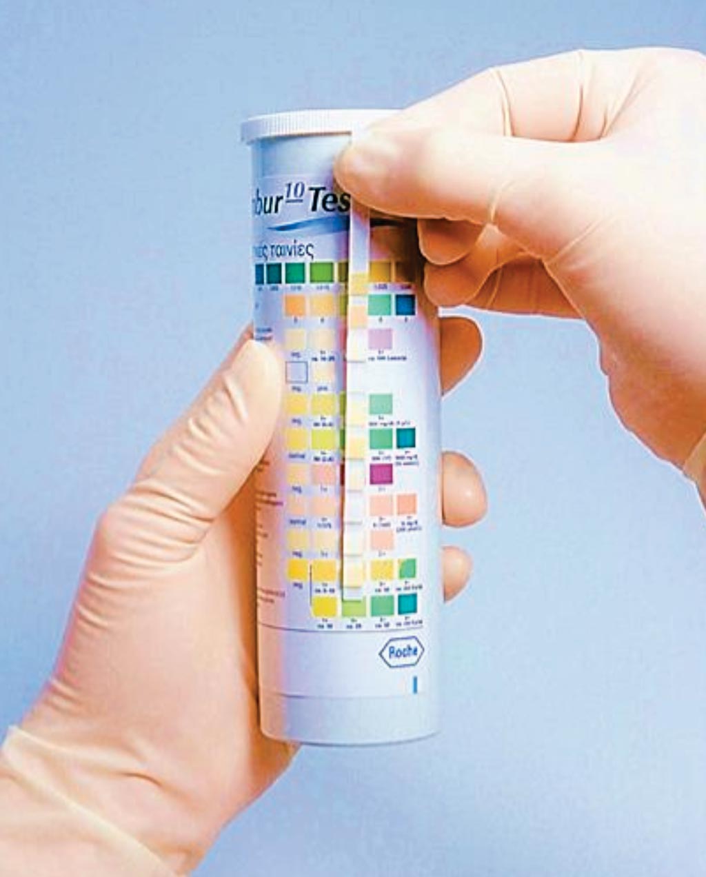 Image: The Combur-10 brand of reagent strips for urinalysis can be used for cerebrospinal fluid analysis (Photo courtesy of Roche Diagnostics).