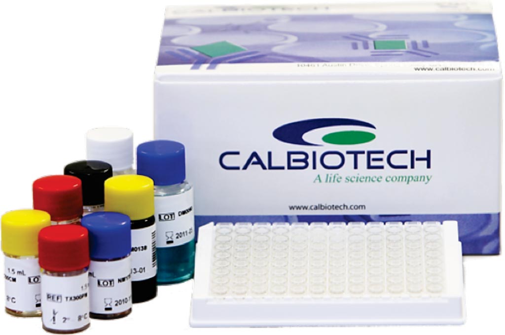 The enzyme-linked immunosorbent assay for estradiol (E2) (Photo courtesy of Calbiotech).