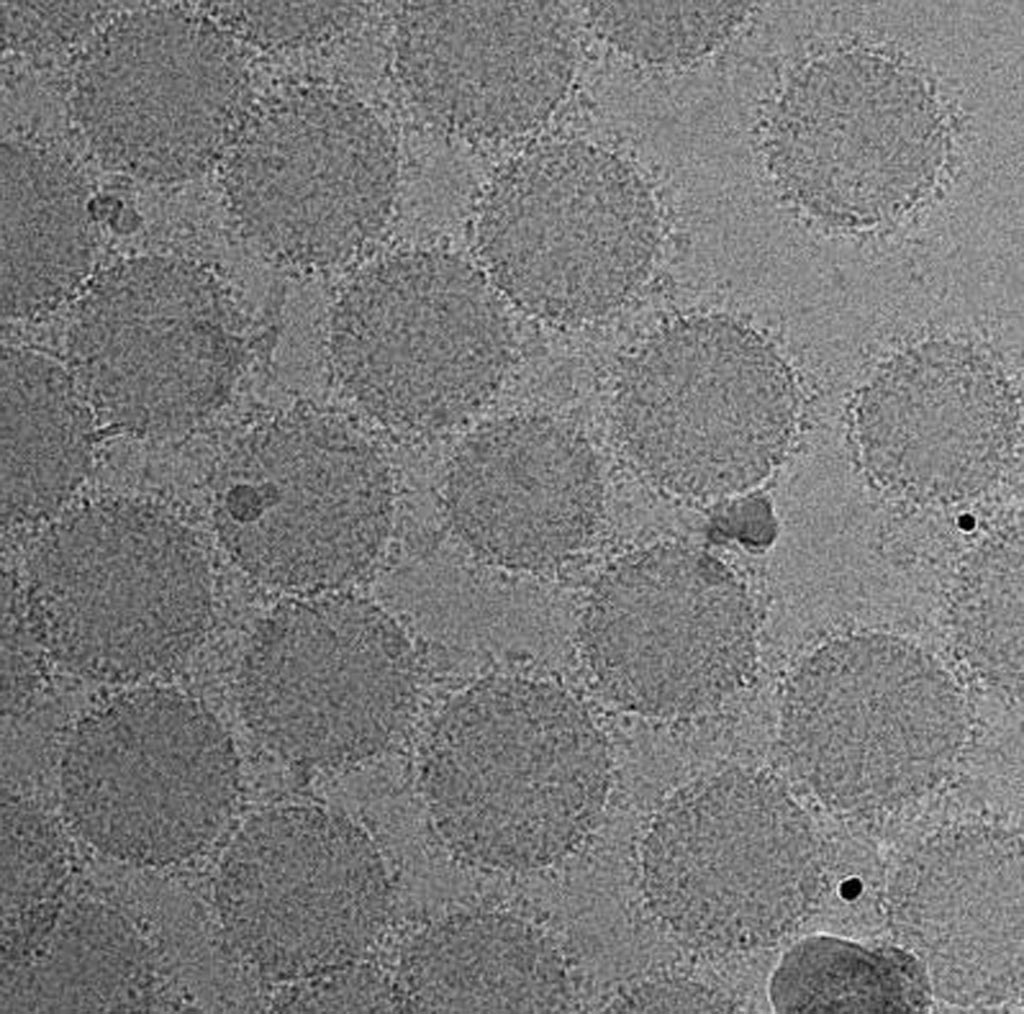 Image: Transmission electron microscopy (TEM) image showing the formation of biom2olecular corona around the surface of nanoparticles (Photo courtesy of Dr. Morteza Mahmoudi, Brigham and Women\'s Hospital).