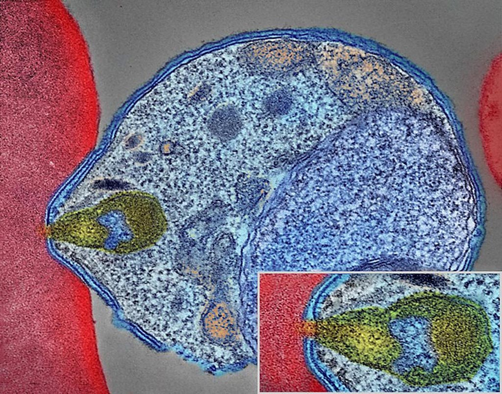Цветная электронная микрофотография, показывающая малярийного паразита (справа, синего цвета), сцепленного с эритроцитом человека. На вставке показан фрагмент точки контакта при большем увеличении (фото любезно предоставлено [США] NIAID через Wikimedia Commons).