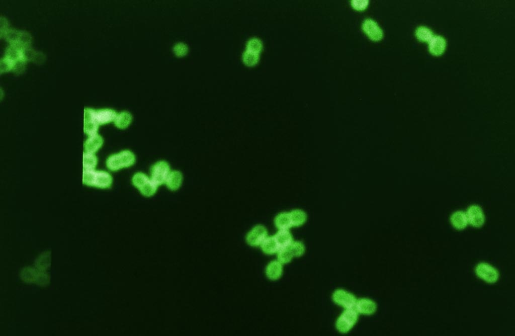 Image: Digitally colorized photomicrograph of fluorescent antibody labeled Streptococcus pneumoniae bacteria in spinal fluid sample (Photo courtesy of the CDC).