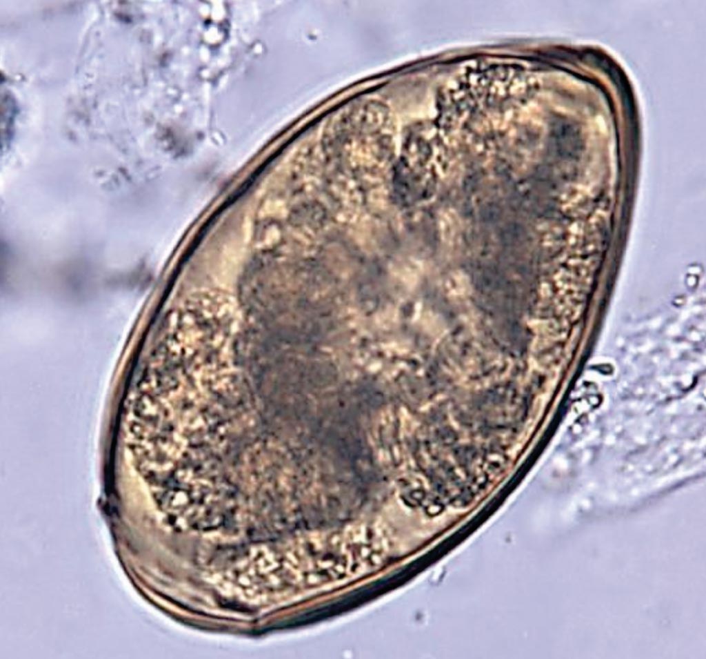 Image: A photomicrograph of an unstained, formalin preserved stool specimen mount, revealed the presence of a Paragonimus westermani trematode egg. Human infections of this lung fluke are most common in eastern Asia and in South America (Photo courtesy of the CDC).