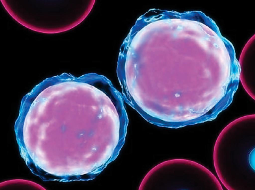 Image: Defective Selection of Autoreactive B Cells seen in Systemic Lupus Erythematosus (Photo courtesy of Sebastian Kaulitzki).