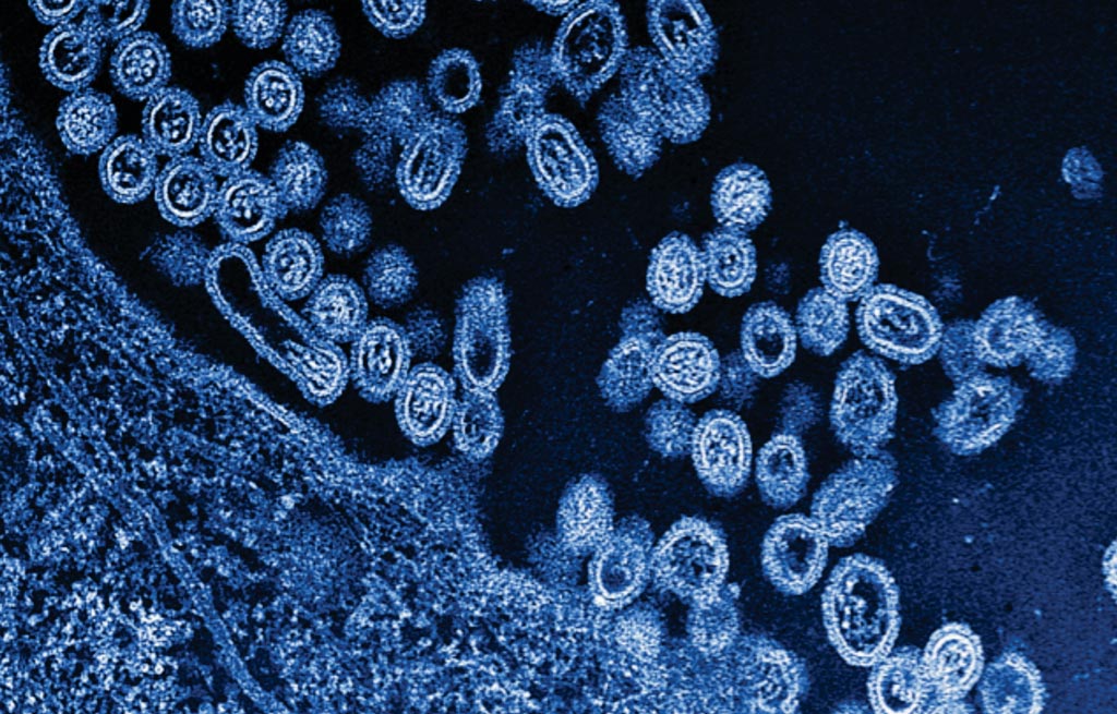 Image: A scanning electron micrograph (SEM) of infectious particles of the avian H7N9 virus emerging from a cell (Photo courtesy of Medical Xpress).