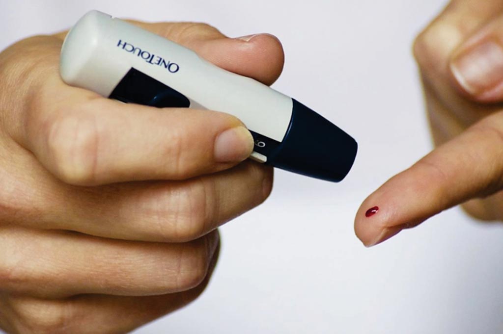 Image: New research suggests random plasma blood glucose tests can identify diabetes patients (Photo courtesy of Chris Hannemann).