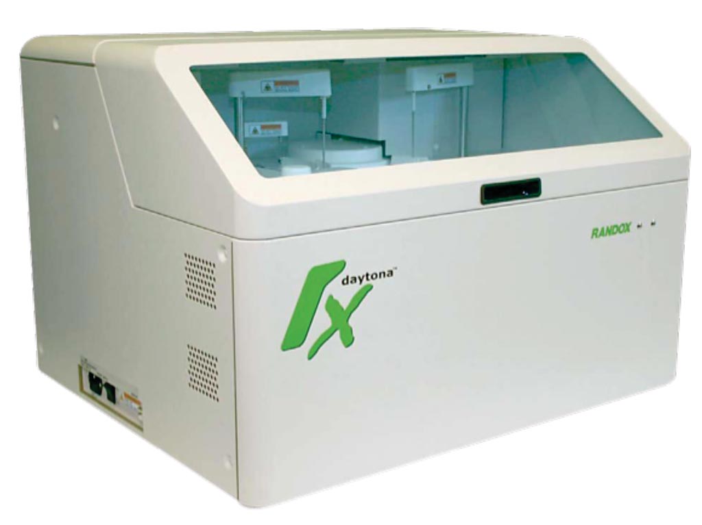 Химический анализатор RX Daytona – компактный, полностью автоматизированный настольный клинический химический анализатор, идеально подходящий для лабораторий с малой и средней пропускной способностью (фото любезно предоставлено Randox Laboratories).