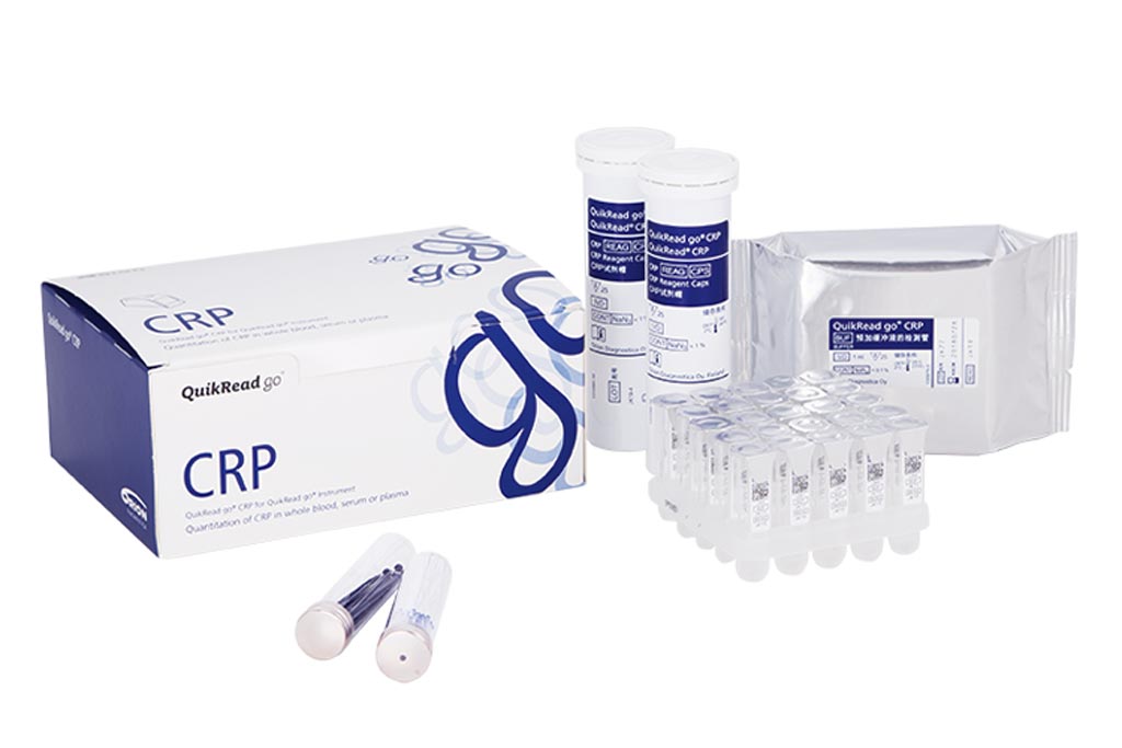 Image: The QuikRead go CRP test is designed as an immunoturbidimetric assay for the in vitro quantitative determination of C-reactive protein (CRP) in K2-EDTA and lithium heparin whole blood, K2-EDTA and lithium heparin plasma, and in serum samples (Photo courtesy of Orion Diagnostica).