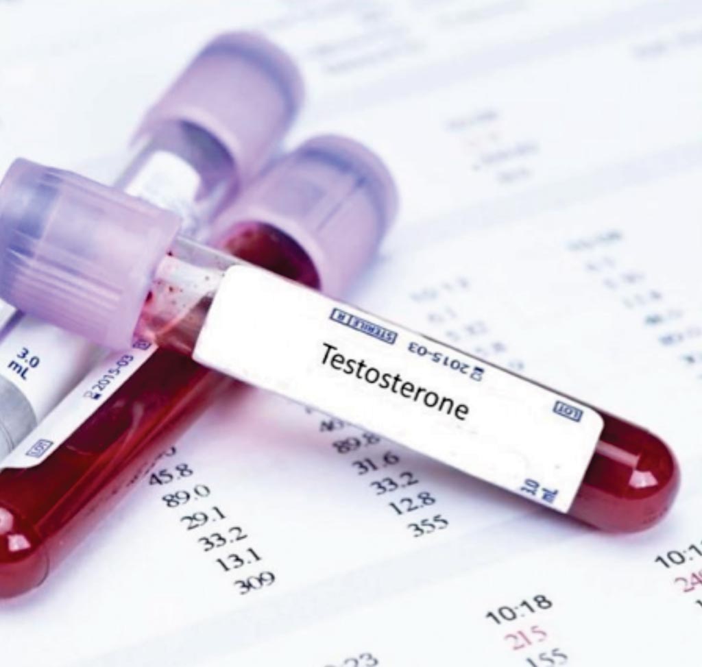Image: A new study showed men with diabetes had a higher blood testosterone level than non-diabetic men (Photo courtesy of Diamed Diagnostical Center).