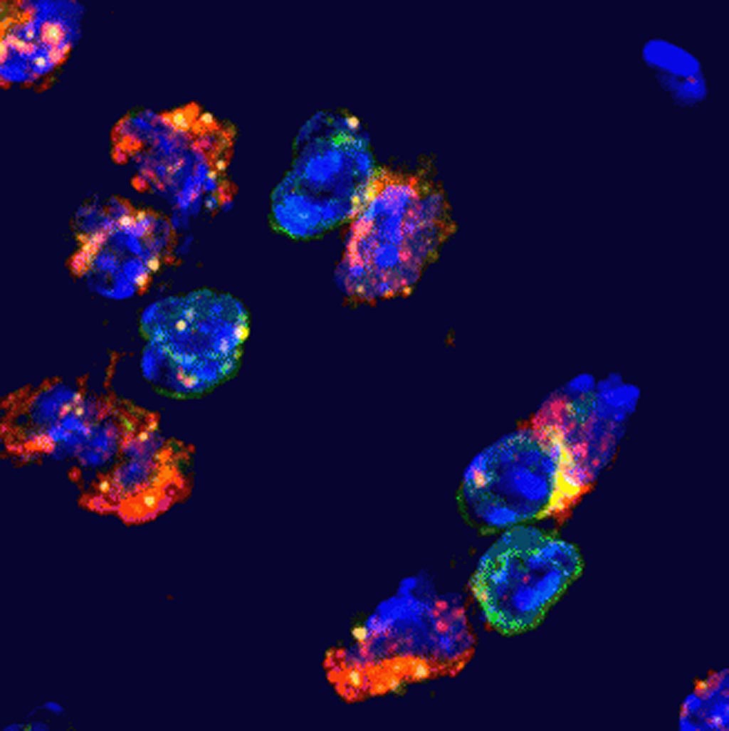 Image: Follicular helper T-cells (cells with green surface markers) interact closely with B-cells (cells with orange surface markers) to facilitate the proliferation of B- cells and the production of high affinity antibodies. The interaction site is shown in yellow, DNA in blue (Photo courtesy of Joyce Hu, La Jolla Institute for Allergy and Immunology).