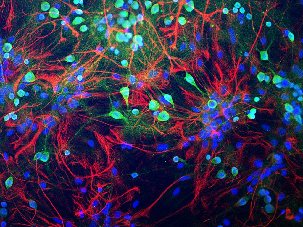 Image: Neurons from rat brain tissue stained green with antibody to ubiquitin C-terminal hydrolase L1 (UCH-L1), which highlights the cell body strong and the cell processes more weak. Astrocytes are stained in red with antibody to the GFAP protein found in cytoplasmic filaments. Nuclei of all cell types are stained blue with a DNA binding dye (Photo courtesy of Wikimedia Commons).