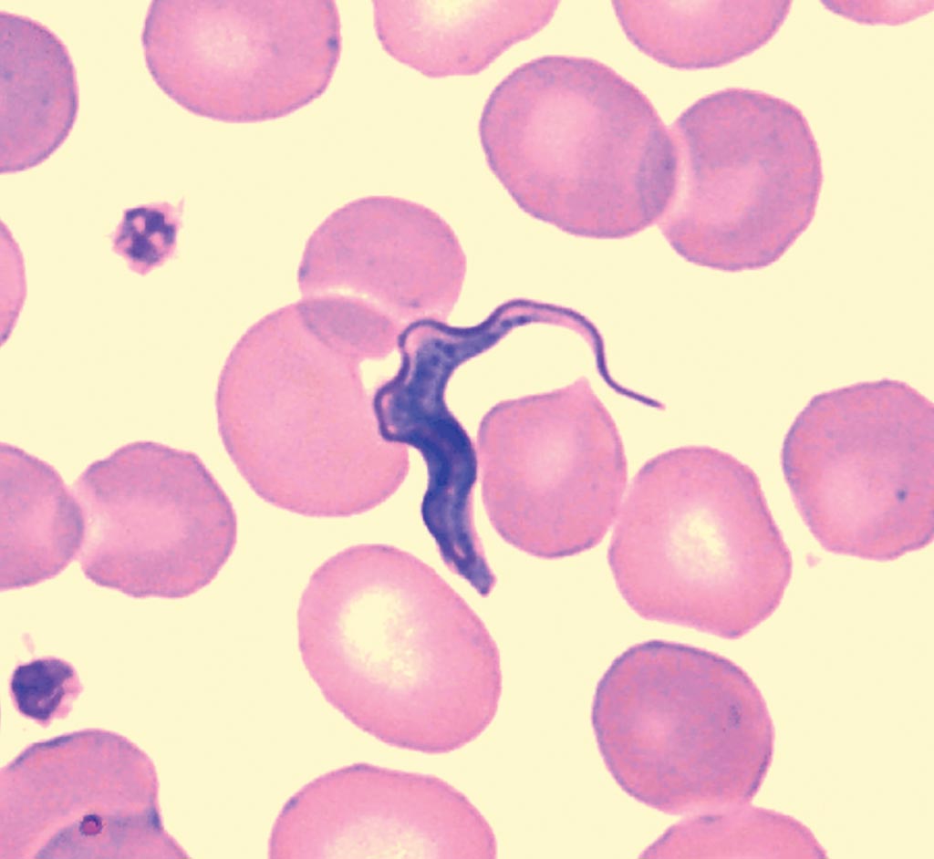 Image: A photomicrograph showing Trypanosoma brucei gambiense in a blood film. This parasitic protozoan species causes African trypanosomiasis (or sleeping sickness) in humans via the tsetse fly (Photo courtesy Alain G.C. Buguet).