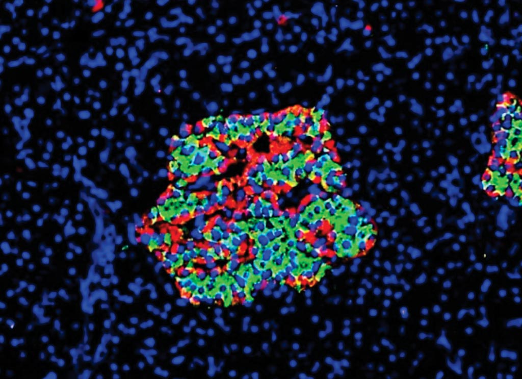 Image: Islet of Langerhans from the pancreas of a patient with chronic Type 1 diabetes of 19 years duration. A single lobe of the pancreas was found to contain islets rich in residual beta cells (alpha cells in red; beta cells in green) (Photo courtesy of Diapedia).