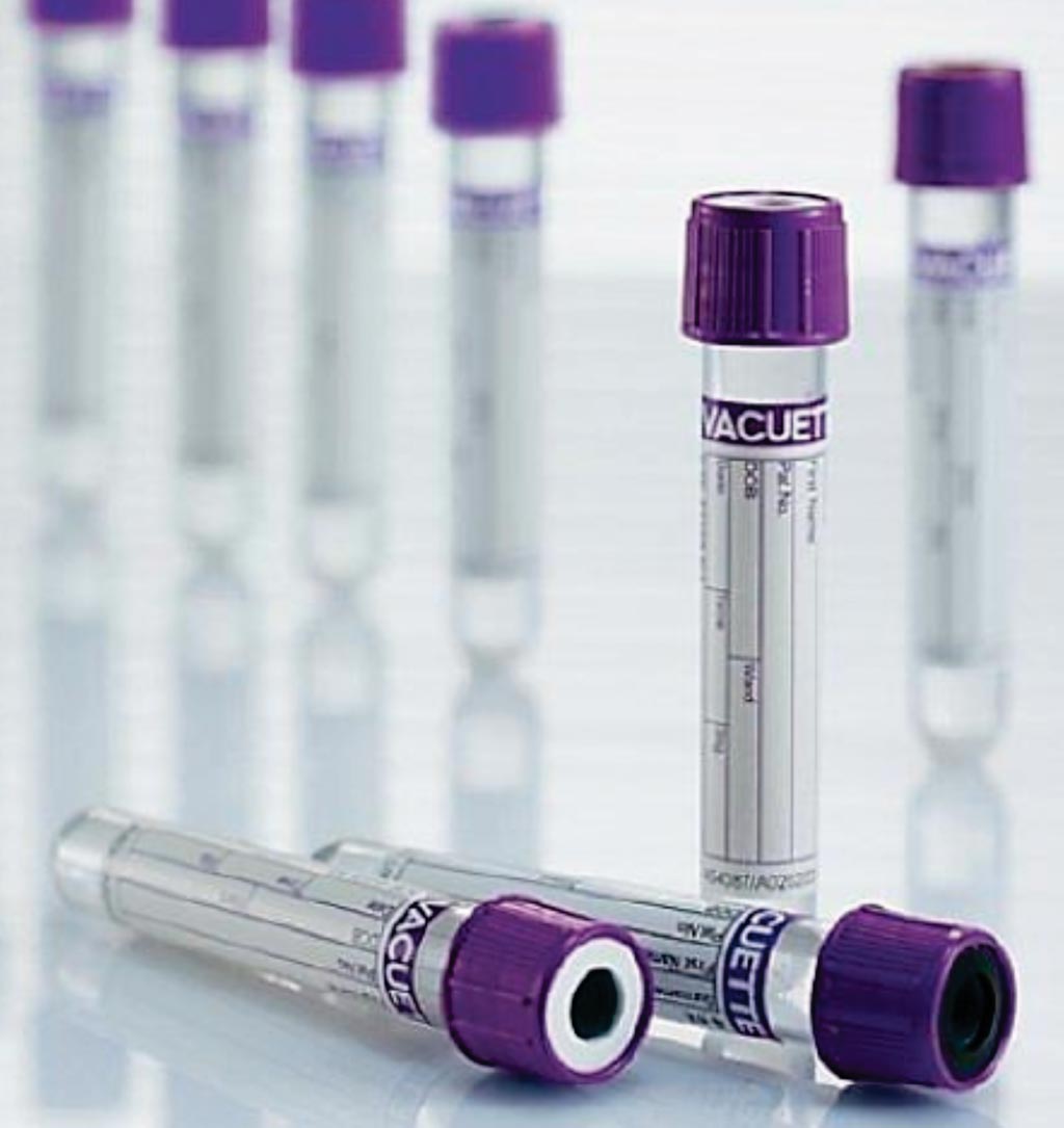 Image: The VACUETTE Venous K2EDTA blood collection tubes were found the most suitable for the pre-analytical conditions for serotonin assays (Photo courtesy of Greiner Bio-One).