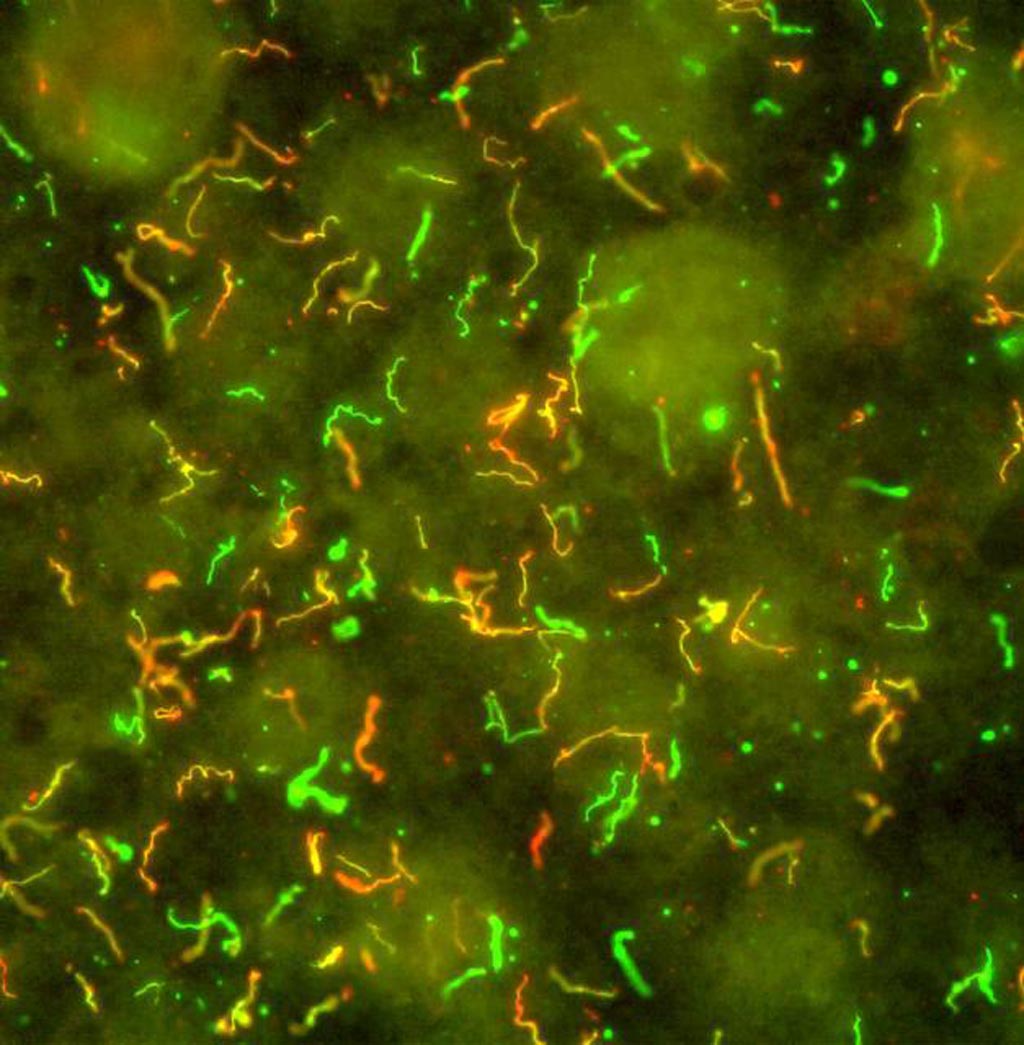 Image: In this photomicrograph, the spiral-shaped bacteria that cause Lyme disease, Borrelia burgdorferi, have been illuminated using red and green fluorescent antibodies (Photo courtesy of the National Institute of Allergy and Infectious Diseases).