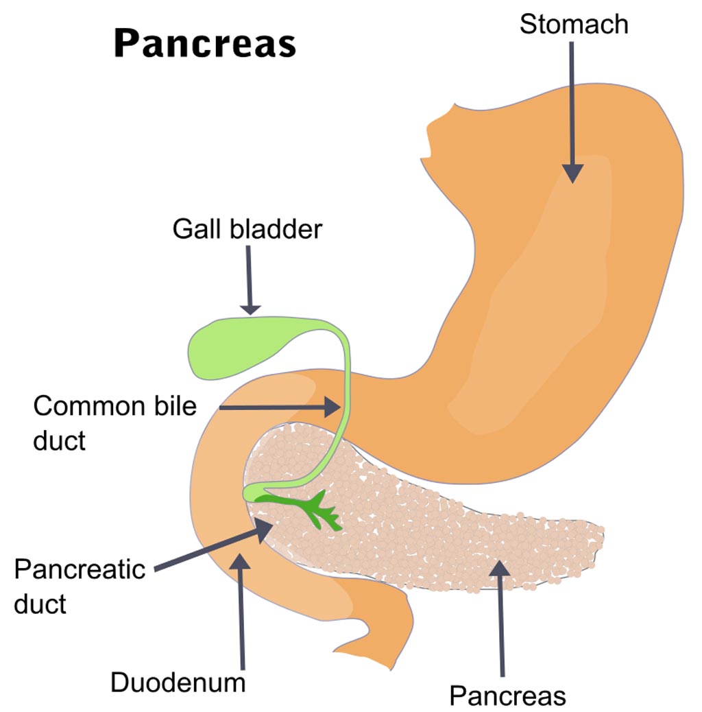 Image: The pancreas and surrounding organs (Photo courtesy of Wikimedia Commons).
