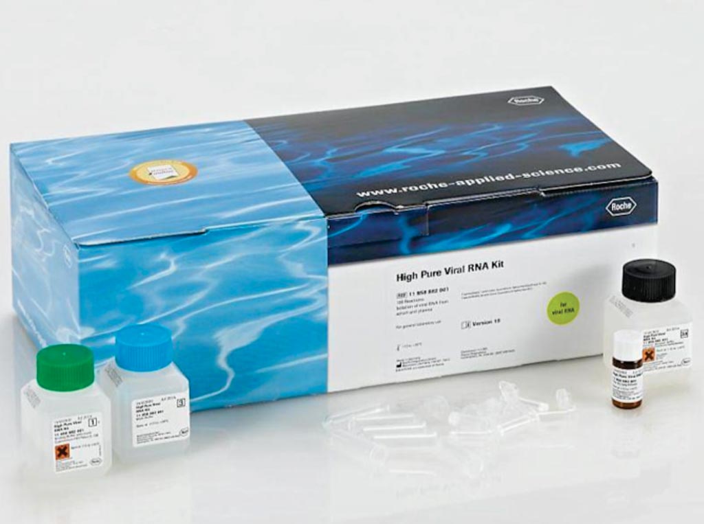 Image: The High Pure Viral RNA Kit is for general laboratory use and purifies viral RNA from a variety of samples such as serum and plasma (Photo courtesy of Roche Diagnostics).