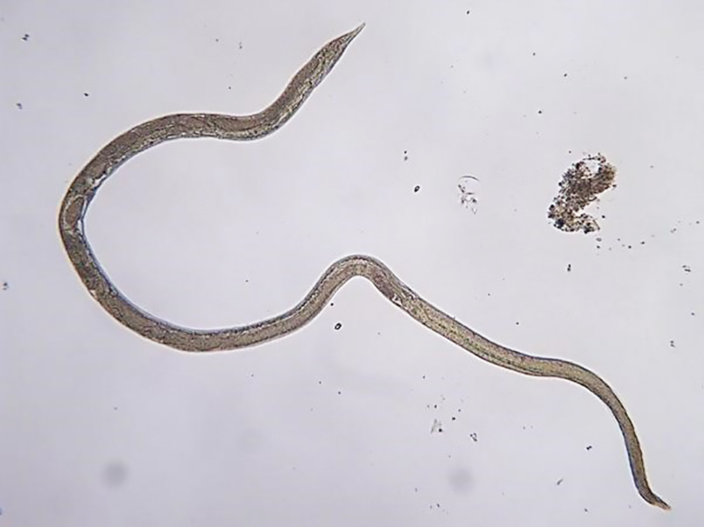 Image: Strongyloides stercoralis adult. The parasitic female lives threaded into the mucosal epithelium of the human small intestine (Photo courtesy of UVM Ecological Parasitology).