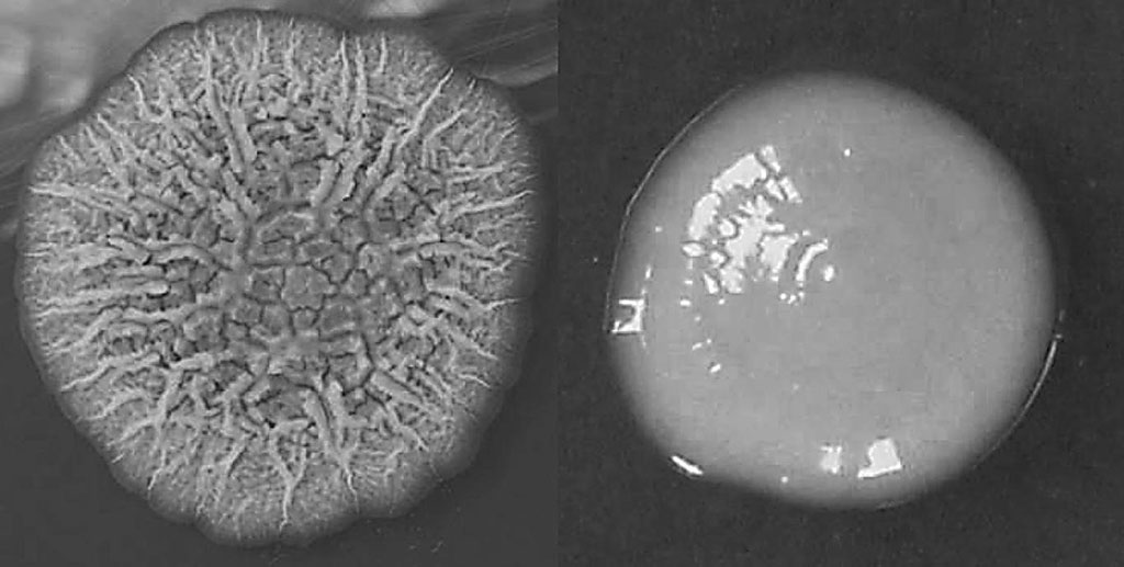 Image: Growth characteristics of rough and smooth phenotypes of Mycobacterium abscessus on 7H11 agar cultured at 37 °C: representative single rough (left) and smooth (right) colonies (Photo courtesy of Hannover Medical School)