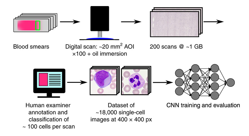 Image: Schematic diagram of how the deep learning algorithm classifies leukocytes in a blood smear in an automated and standardized way (Photo courtesy of Helmholtz Zentrum München / Dr. Carsten Marr)