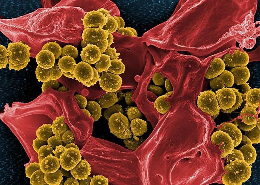 Image: Digitally colorized scanning electron micrograph (SEM) depicts numerous mustard-colored, spheroid shaped, methicillin-resistant, Staphylococcus aureus (MRSA) bacteria, enmeshed within the pseudopodia of a red-colored human neutrophil (Photo courtesy of National Institute of Allergy and Infectious Diseases).