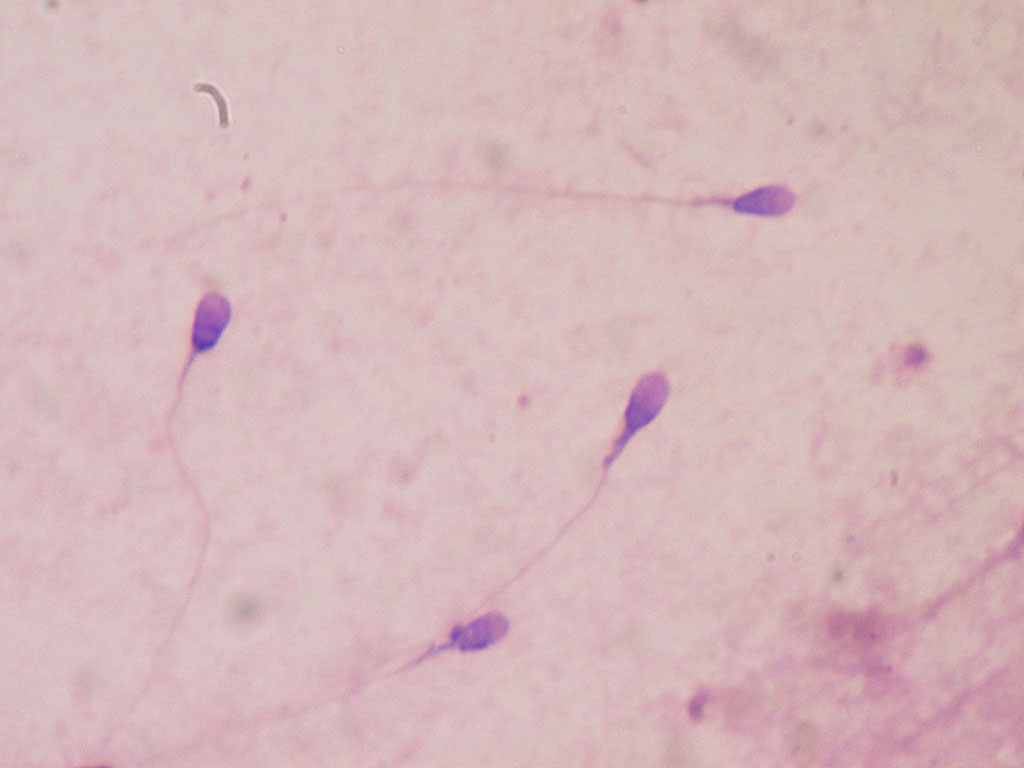 Image:  Human sperm stained for semen quality testing in the clinical laboratory (Photo courtesy of Wikimedia Commons)