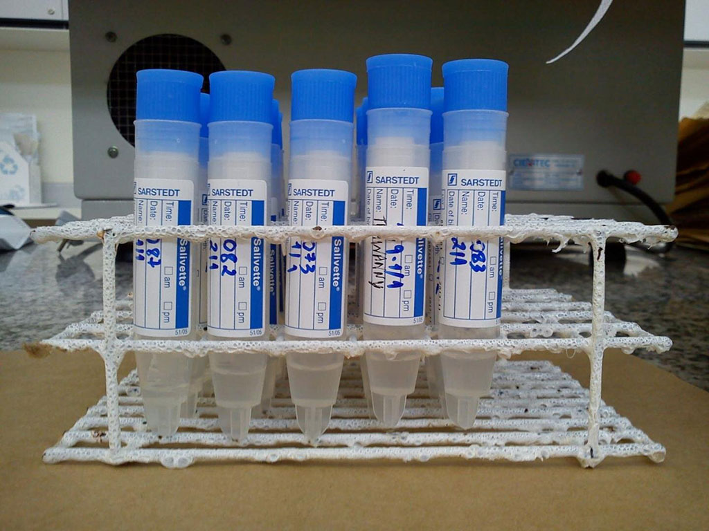 Image: The level of uric acid in saliva is a good indicator of body fat percentage in a study designed to identify reliable biomarkers that can be used to develop quick non-invasive tests for early detection of chronic diseases ((Photo courtesy of Dr. Paula Midori Castelo, Federal University of São Paulo)