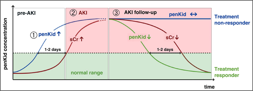 Image: The penKid assay allows the measurement of actual kidney function with a simple blood draw. Being non-inferior to the gold standard, rising and decreasing penKid values reveal worsening and improving of kidney function independent from inflammation or any other comorbidity, allowing the inclusion of all critical ill patients (Photo courtesy of SphingoTec GmbH).