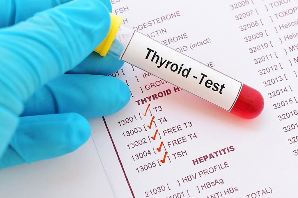 Image: Biochemical thyroid screening is recommended as part of routine management for type 1 and type 2 diabetes (Photo courtesy of Alzyme).
