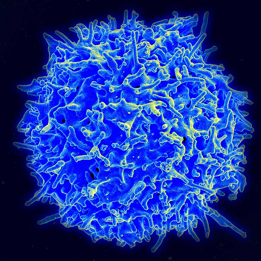 Image: Scanning electron micrograph of a human T-cell (Photo courtesy of Wikimedia Commons)