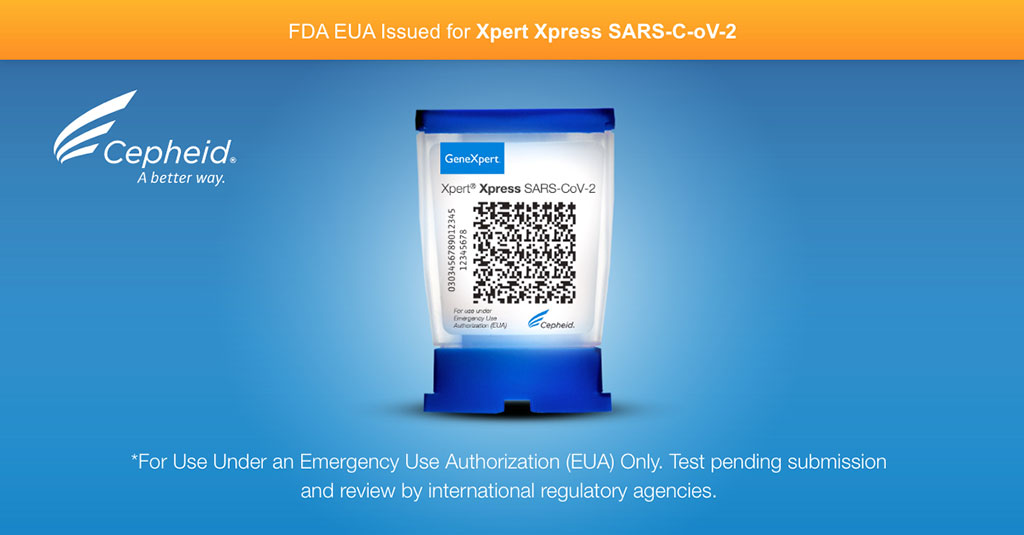 Image: FDA EUA issued for Xpert Xpress SARS-C-oV-2 (Photo courtesy of Cepheid)