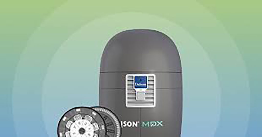 Image: The LIAISON MDX platform (Photo courtesy of DiaSorin Inc.)