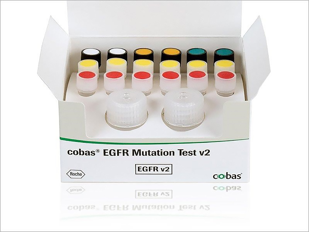 Image: The cobas Epidermal Growth Factor Receptor (EGFR) gene Mutation Test v2 (Photo courtesy of Roche).