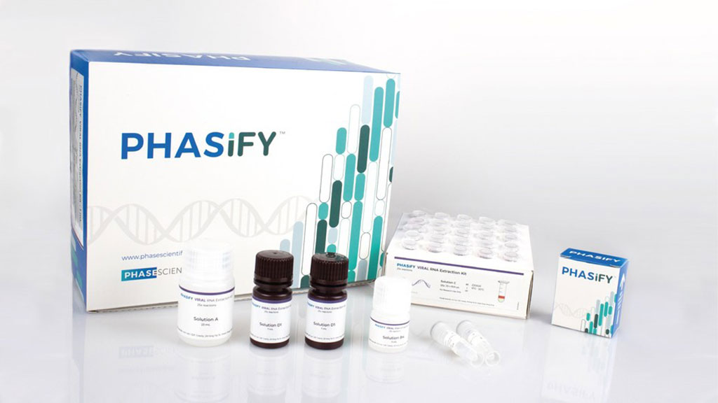 Image: PHASIFY VIRAL RNA Extraction Kit (Photo courtesy of PHASE Scientific)