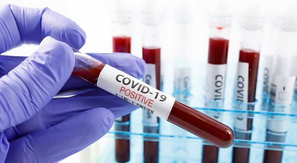 Image: Antibody Detection Is Critical for COVID-19 Diagnosis (Photo courtesy of Minnesota Department of Health).