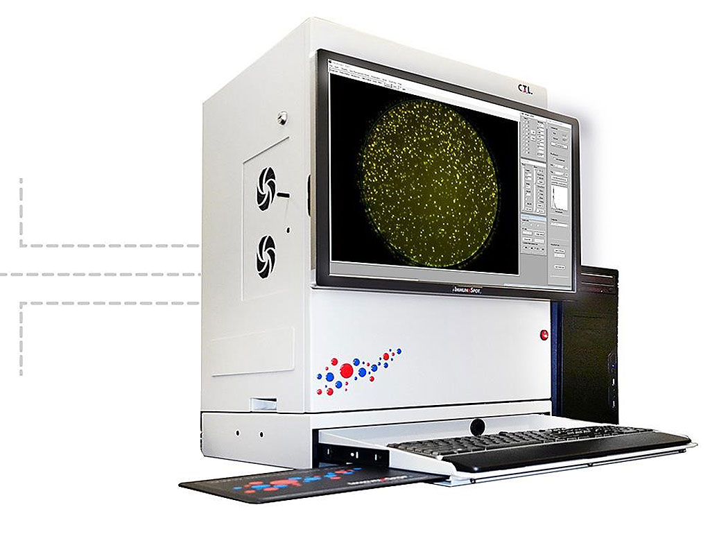 Image: CTL- Immunospot Analyzers come in a wide range of models, each of which is designed to make assay analysis faster, easier, and more accurate than ever before (Photo courtesy of Cellular Technology Limited).