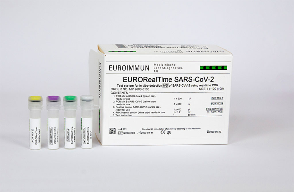 Image: EuroRealTime SARS-CoV-2 molecular assay COVID-19 (Photo courtesy of PerkinElmer, Inc.)