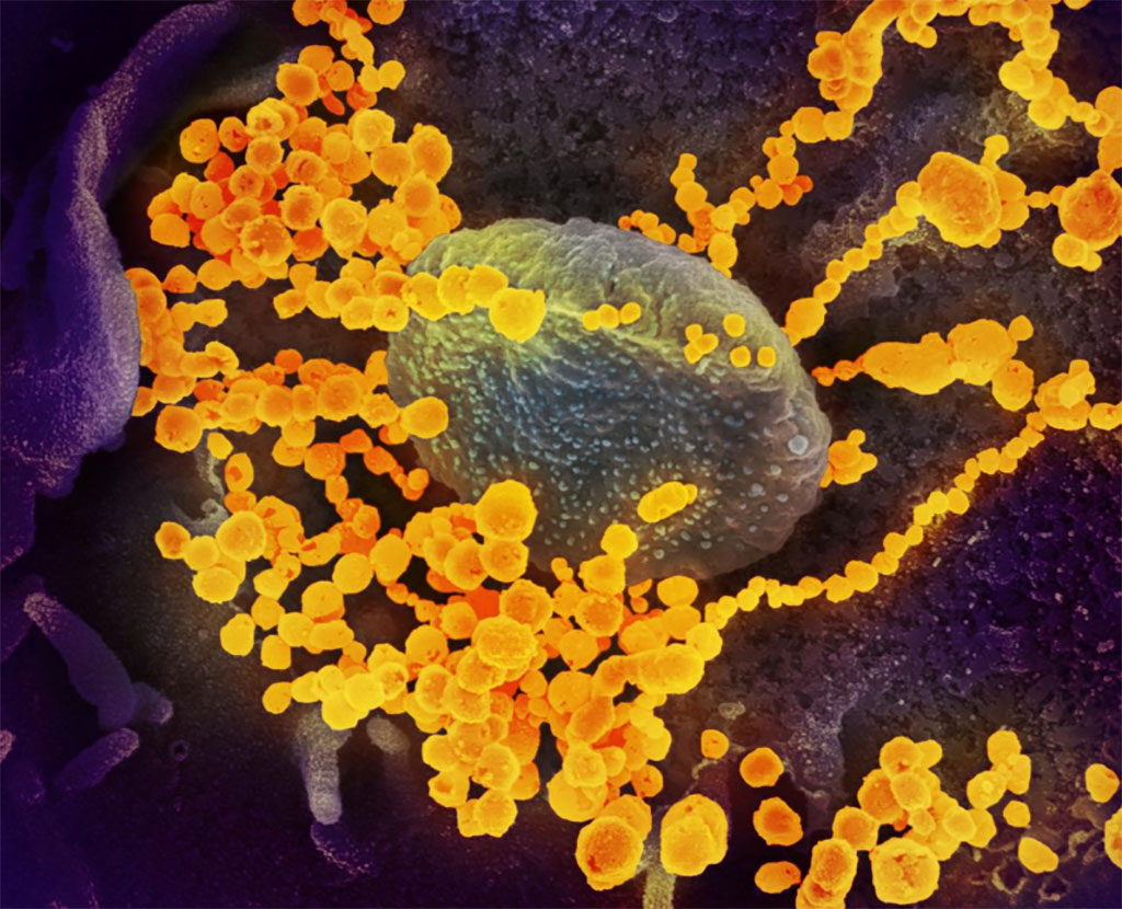 Image: An undated scanning electron microscope image shows SARS-CoV-2 (round gold objects), also known as novel coronavirus, the virus that causes COVID-19, emerging from the surface of cells cultured in the lab and isolated from a patient in the U.S. (Photo courtesy of NIAID)