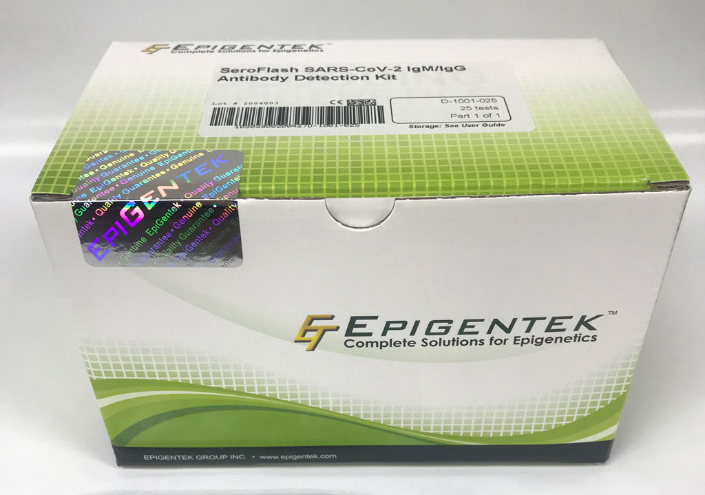 Image: EpiGentek Launches First-to-Market Kits to Detect SARS-CoV-2-Targeted Furin Activity and Screen for Inhibitors against COVID-19 (Photo courtesy of EpiGentek)