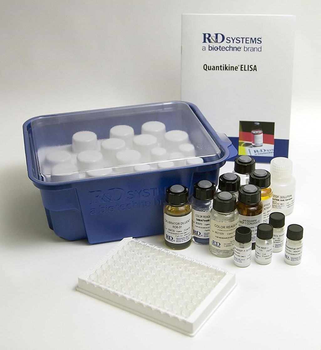 Image: The Quantikine ELISA Human Lipocalin-2/NGAL Kit is a solid phase sandwich ELISA that quantifies human Lipocalin-2/NGAL in serum, heparin plasma, saliva, and urine (Photo courtesy of R&D Systems).