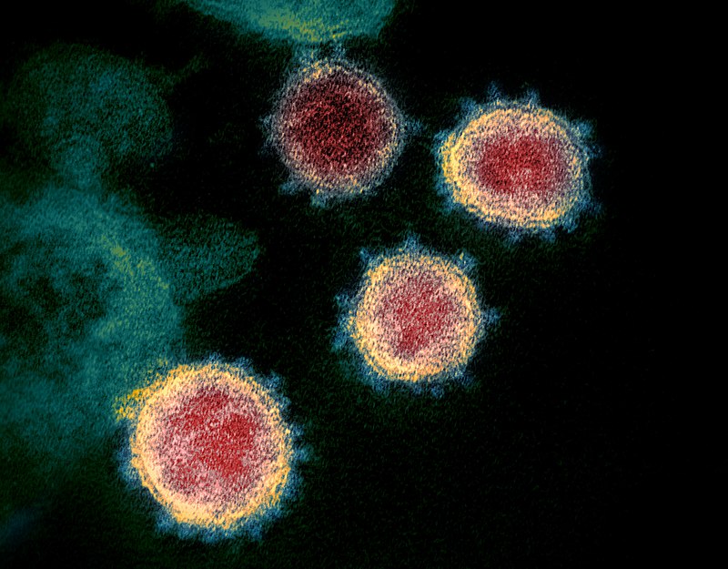Transmission electron microscope image of SARS-CoV-2 (2019-nCoV), the virus that causes COVID-19, isolated from a patient in the U.S.A. Virus particles are shown emerging from the surface of cells cultured in the laboratory. (Image courtesy of National Institute of Allergy and Infectious Diseases via Wikimedia Commons)