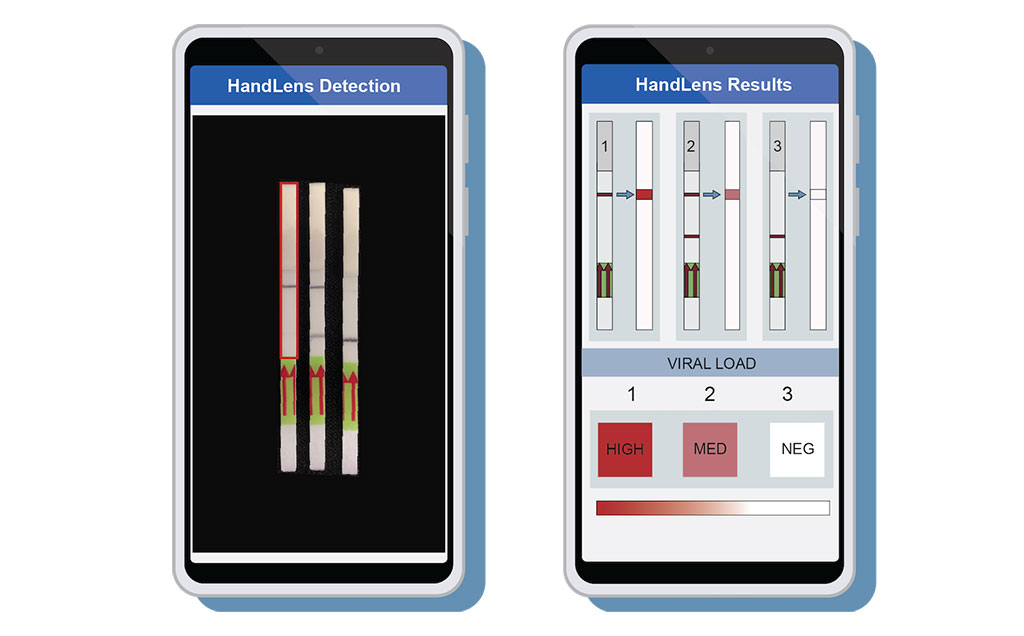 Image: A mobile phone app called HandLens was designed to read and report paper strip SHERLOCK results (Photo courtesy of Anna Lachenauer, Stanford University School of Medicine)