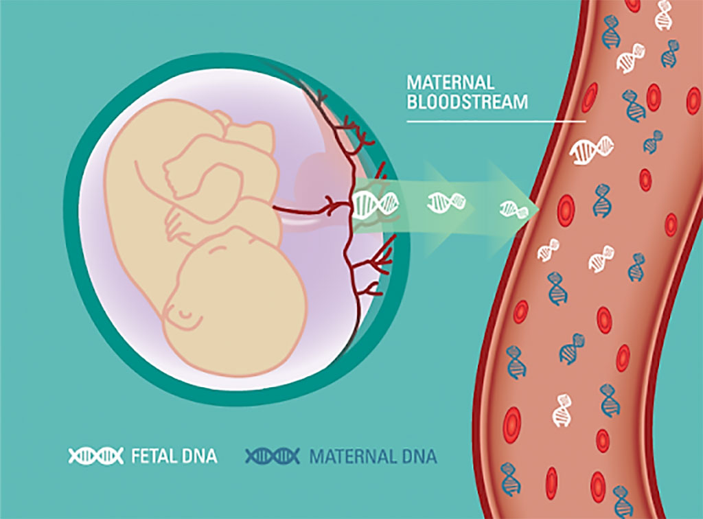 Image: Schematic diagram of fetal and maternal DNA as studied in the detection and characterization of jagged ends of double-stranded DNA in plasma (Photo courtesy of Ariosa Diagnostics).