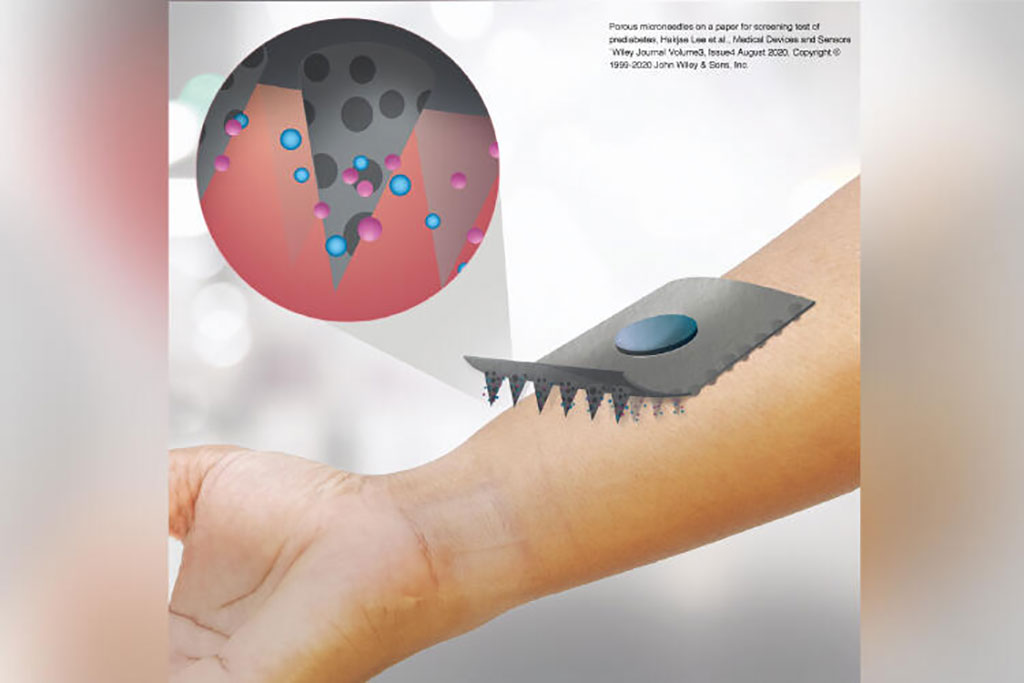 Image: Illustration demonstrating painless and biodegradable microneedles on a paper patch (Photo courtesy of University of Tokyo)